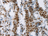 IL17C Polyclonal Antibody Store at -20°C