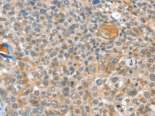 ALDOB Polyclonal Antibody Store at -20°C
