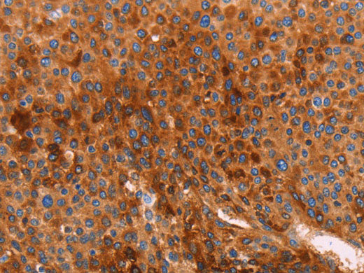 GC Polyclonal Antibody Store at -20°C