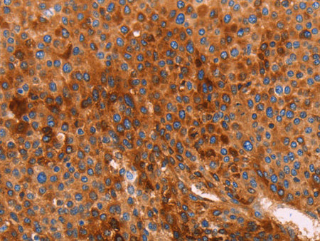 GC Polyclonal Antibody Store at -20°C