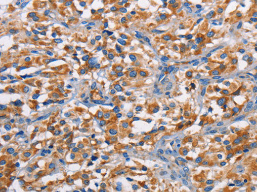 PIM2 Polyclonal Antibody Store at -20°C