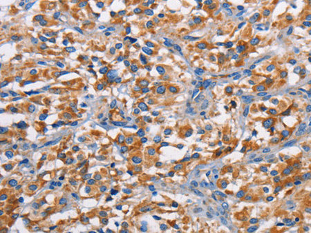 PIM2 Polyclonal Antibody Store at -20°C