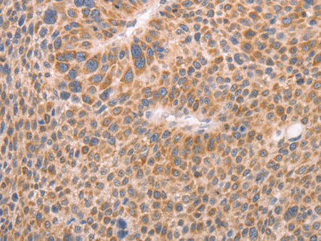 AASDHPPT Polyclonal Antibody Store at -20°C