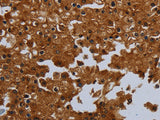 ENTPD7 Polyclonal Antibody Store at -20°C