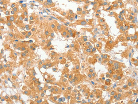 COL4A3BP Polyclonal Antibody Store at -20°C