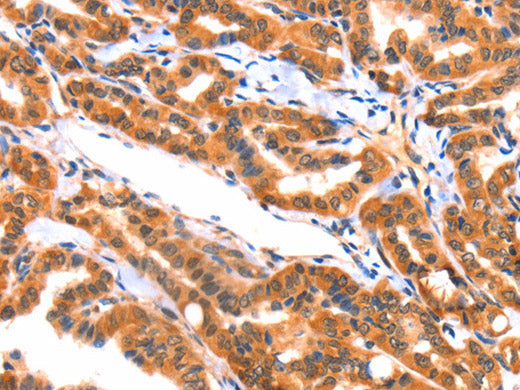 AK5 Polyclonal Antibody Store at -20°C