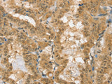 PSMC1 Polyclonal Antibody Store at -20°C
