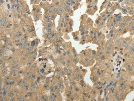 PSMD9 Polyclonal Antibody Store at -20°C