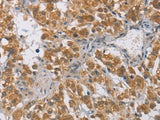 DIO1 Polyclonal Antibody Store at -20°C