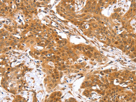 RGS22 Polyclonal Antibody