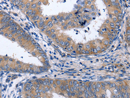 NPPB Polyclonal Antibody Store at -20°C