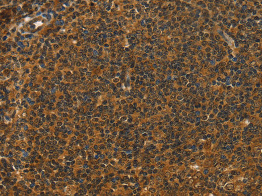 STAR Polyclonal Antibody Store at -20°C
