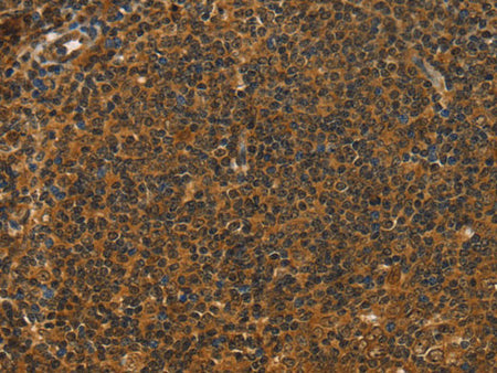 STAR Polyclonal Antibody Store at -20°C