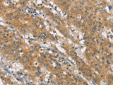 NLRP7 Polyclonal Antibody Store at -20°C