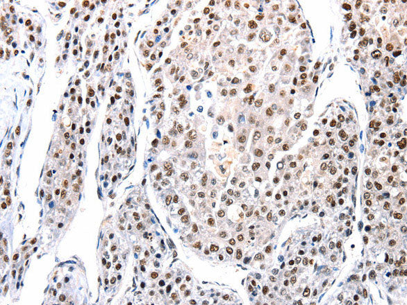 AQP2 Polyclonal Antibody Store at -20°C