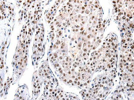 AQP2 Polyclonal Antibody Store at -20°C