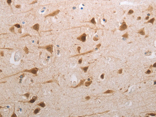 MDC1 Polyclonal Antibody Store at -20°C