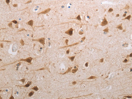 MDC1 Polyclonal Antibody Store at -20°C