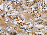 LGALS7 Polyclonal Antibody