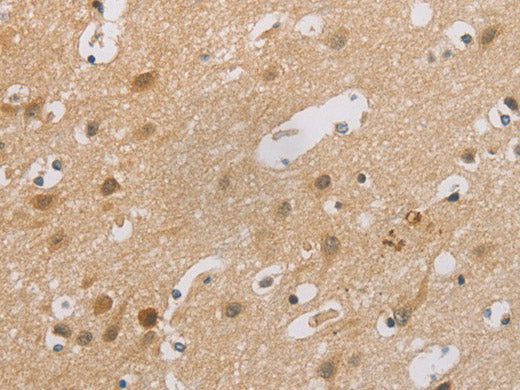 p16 Polyclonal Antibody Store at -20°C