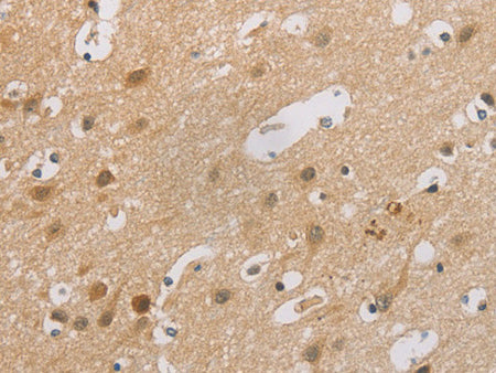 p16 Polyclonal Antibody Store at -20°C