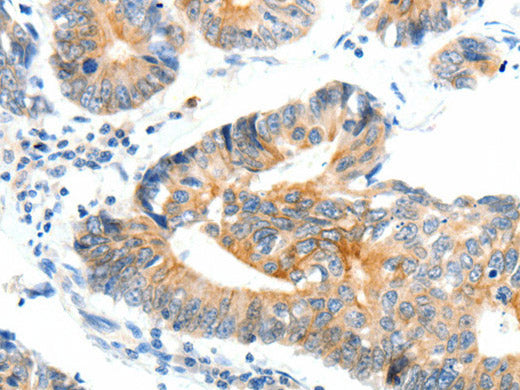 NTRK1 Polyclonal Antibody Store at -20°C