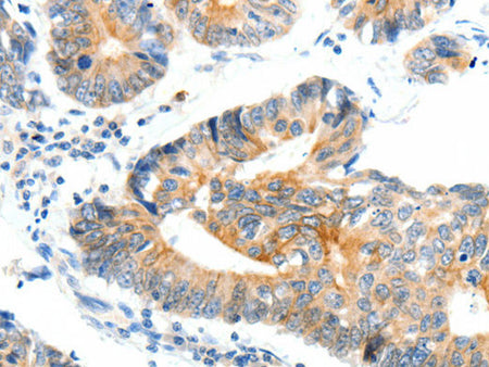 NTRK1 Polyclonal Antibody Store at -20°C