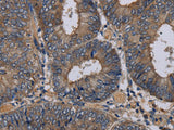 NECTIN3 Polyclonal Antibody