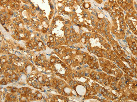 RAB35 Polyclonal Antibody Store at -20°C