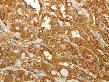 RAB35 Polyclonal Antibody Store at -20°C