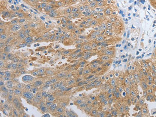 RHEB Polyclonal Antibody Store at -20°C