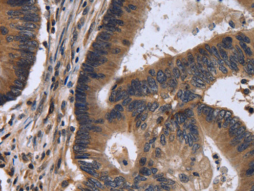 FSTL1 Polyclonal Antibody Store at -20°C