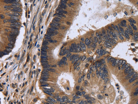 FSTL1 Polyclonal Antibody Store at -20°C