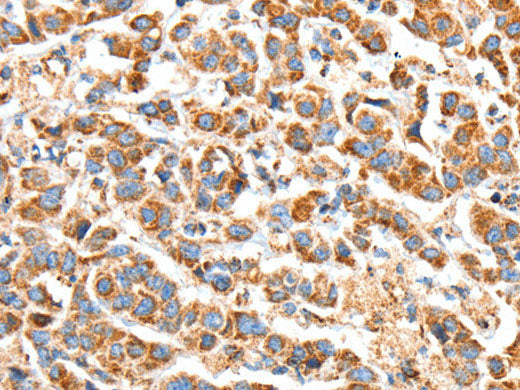 BAK1 Polyclonal Antibody Store at -20°C