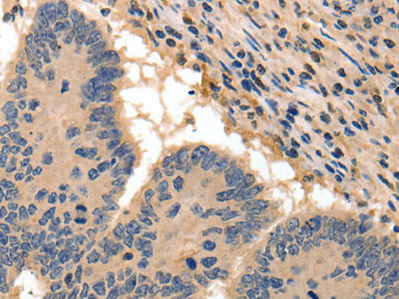 BAIAP2 Polyclonal Antibody Store at -20°C