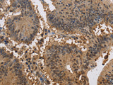 JAG2 Polyclonal Antibody Store at -20°C