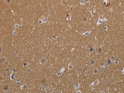 MAGEL2 Polyclonal Antibody