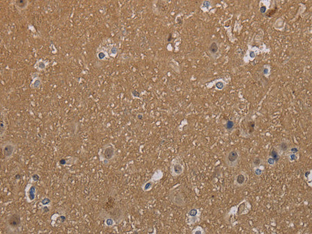 MAGEL2 Polyclonal Antibody