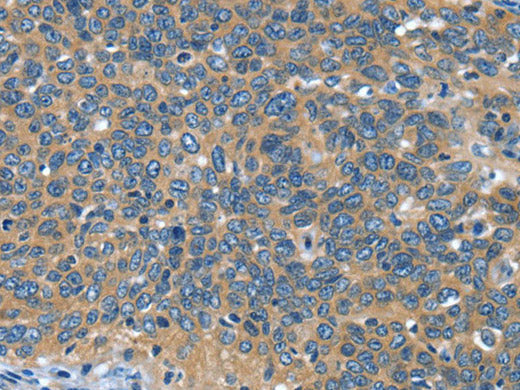 DTX1 Polyclonal Antibody Store at -20°C