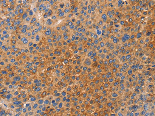 NOD1 Polyclonal Antibody Store at -20°C