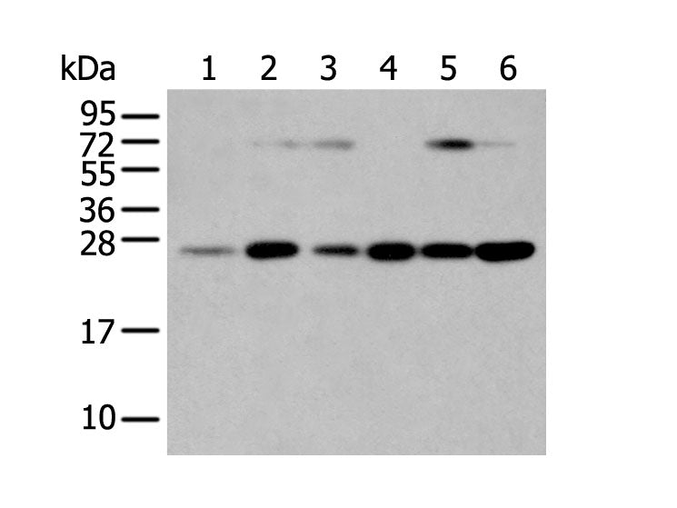 SNAP23 Polyclonal Antibody Store at -20°C