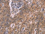 HSD11B2 Polyclonal Antibody Store at -20°C