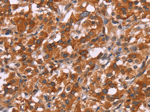 HSPB6 Polyclonal Antibody Store at -20°C