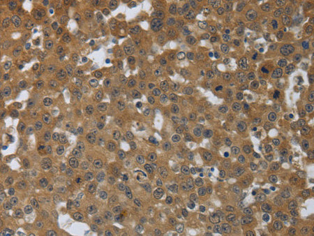 PTPRM Polyclonal Antibody Store at -20°C