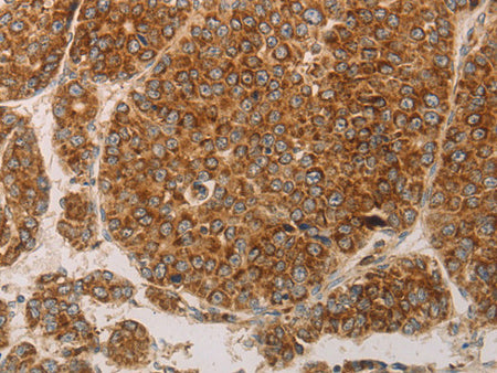 CD31 Polyclonal Antibody Store at -20°C
