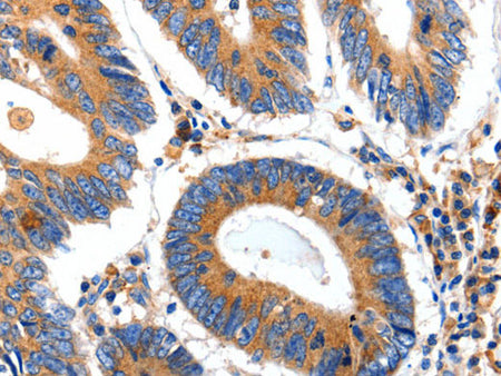 IGFBP7 Polyclonal Antibody Store at -20°C