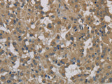 DCTN3 Polyclonal Antibody Store at -20°C