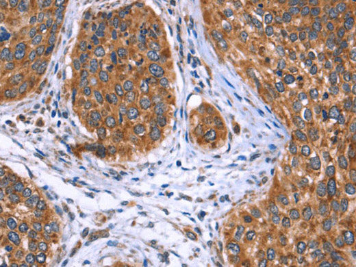 EVC2 Polyclonal Antibody Store at -20°C