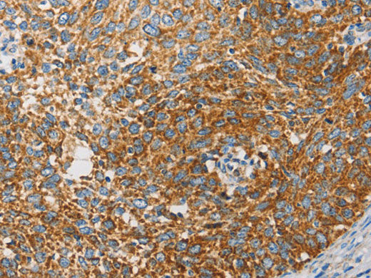 APOBEC3G Polyclonal Antibody Store at -20°C