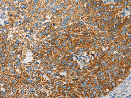 APOBEC3G Polyclonal Antibody Store at -20°C